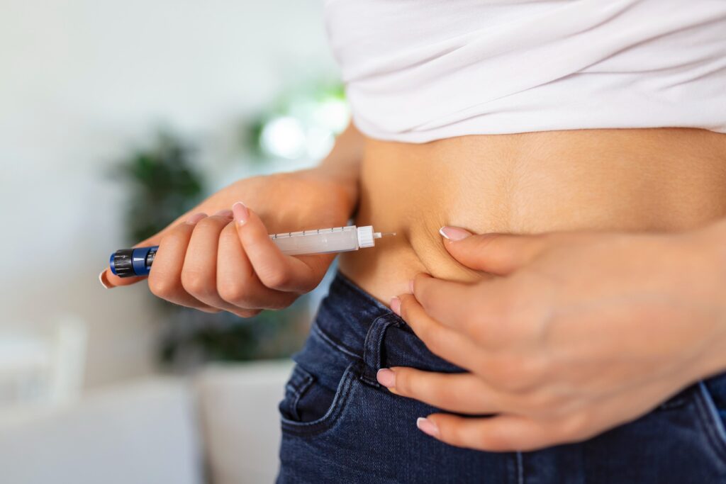 After Bariatric Surgery